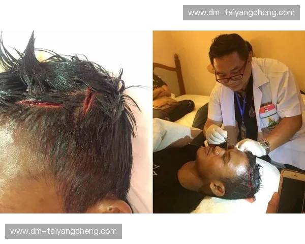 拳台传奇的宿命对决：当卡哈耶遇上播求，一场超越胜负的巅峰之战